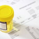 urine in a container for analysis