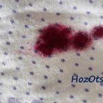 Fucorcin stains on fabric