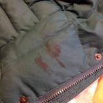 Stain on a down jacket