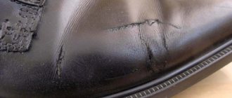 Over time, scratches and scuffs appear on shoes
